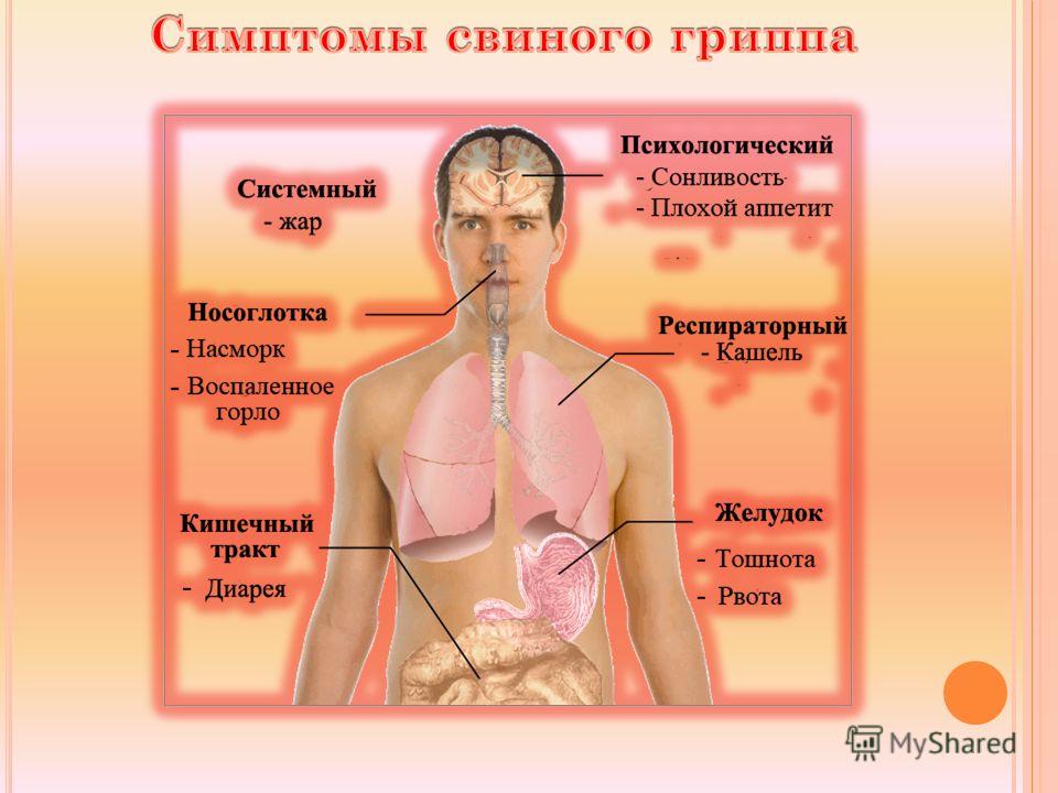 Характерные признаки гриппа. Симптомы св нного гриппа. Свиной грипп симптомы. Симптомы свинрго группа. Симптомы свиноготгриппа.