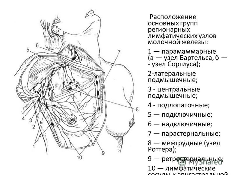 Лимфы подмышек. Схема грудных лимфатических узлов. Лимфатические лимфоузлы аксиллярные. Лимфатический узел Зоргера. Сторожевые лимфоузлы молочной железы.