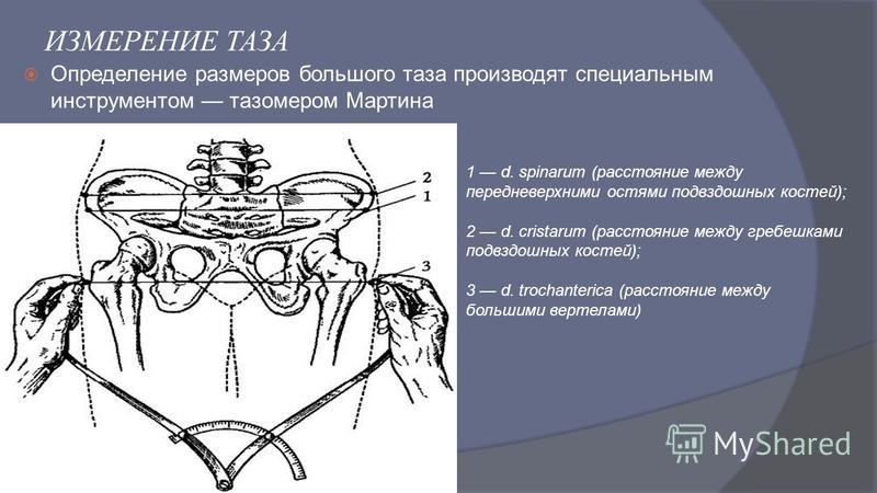 Исследование таза