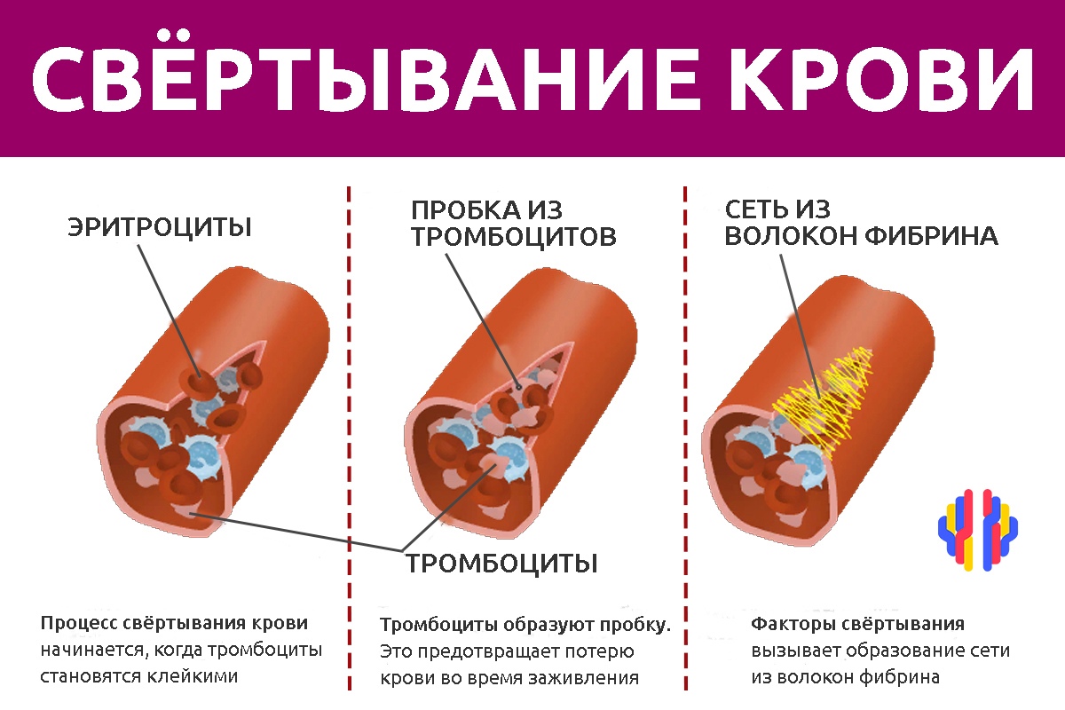 Тромбоциты и тромбы. Тромбоциты схема свертывания крови. Схема двух фаз свертывания крови тромбообразования. Тромбоциты процесс свертывания крови. Тромбоциты в крови фаза свертывание.