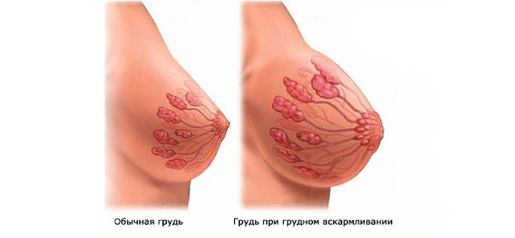 как лечить воспаление груди у женщин фото 107