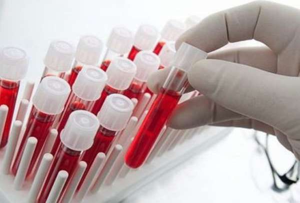 Анализ крови: за сколько часов нельзя есть перед тем как сдавать биоматериал?