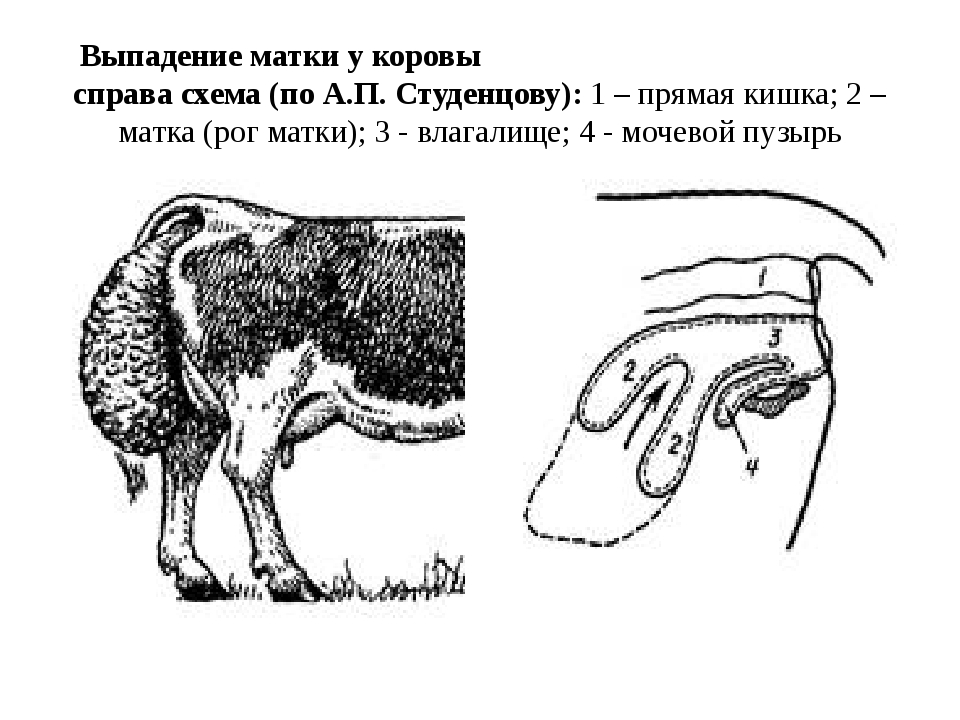 Выпадение прямой кишки карта вызова