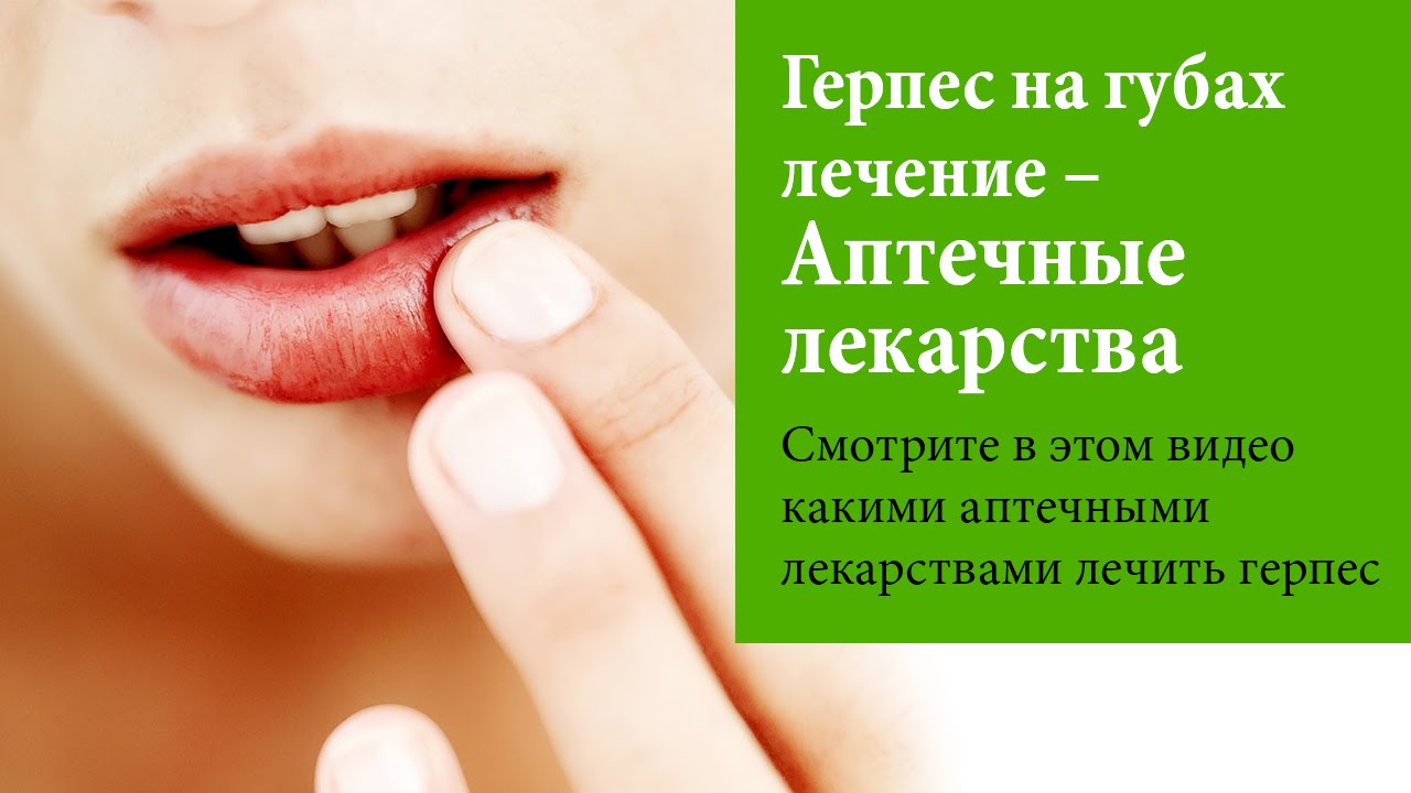 Эффективное лечение герпеса на губах препараты. Герпес на гуюахлечение.