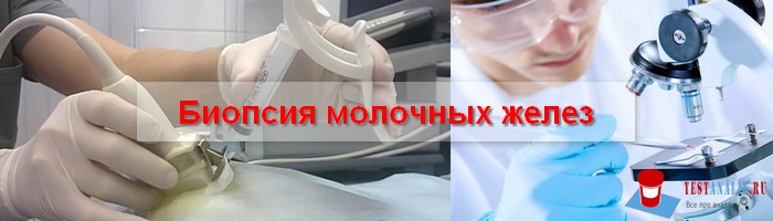 Биопсия молочной. Стереотаксическая биопсия молочной железы. Аспирационная биопсия молочной железы. Толстоигольная биопсия молочной железы. Трепан биопсия молочной железы методика.