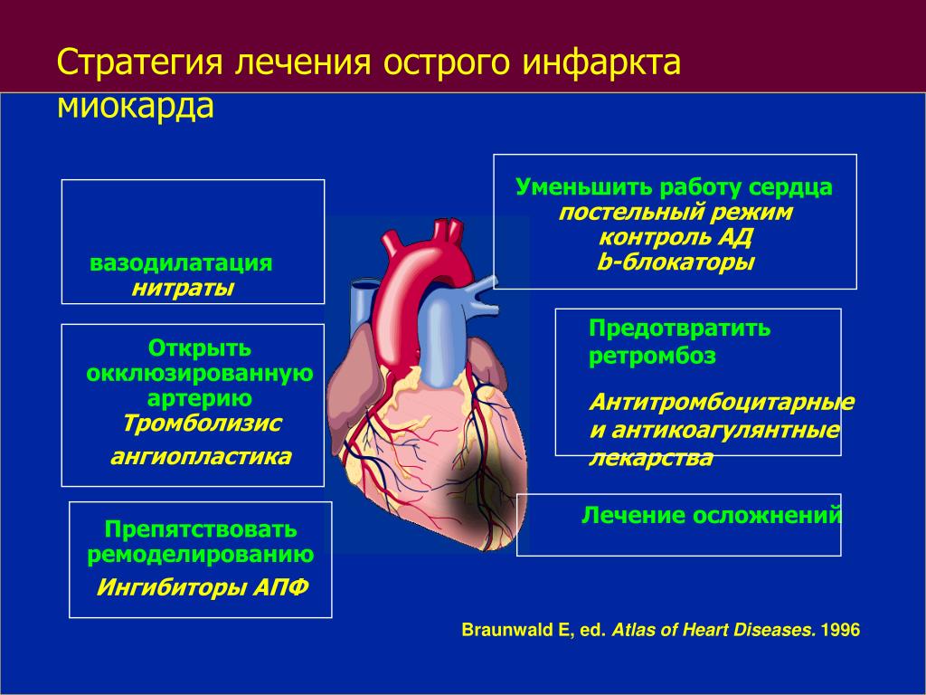 Инфаркт миокарда симптомы первые признаки и лечение. Симптомы ИБС инфаркт миокарда. Острый инфаркт миокарда причины. Острый период инфаркта миокарда клиника.