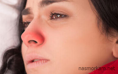 Красный нос: причины и лечение. Что делать при покраснении и воспалении
