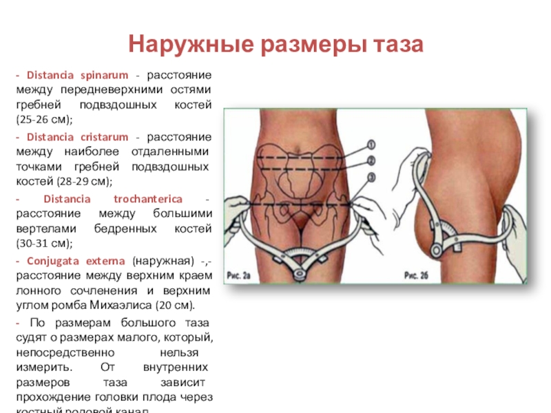 Расстояние между костями. Наружные Размеры нормального таза в акушерстве. Размеры таза Акушерство таблица наружные. Таблица методика измерения женского таза. Размеры женского таза в акушерстве.