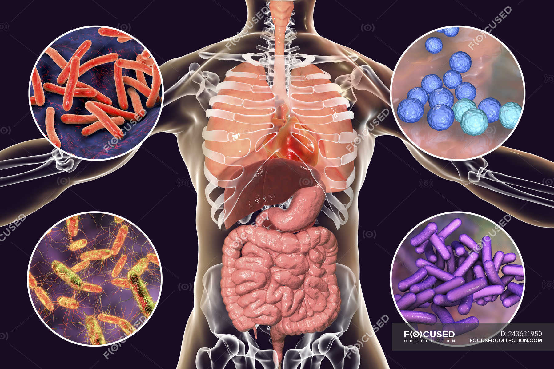 3 заболевание вызванных бактерий. Заболевания от бактерий. Болезни вызывающиеся бактериями. Бактерии заболевания человека. Заболевания которые вызываются бактериями.