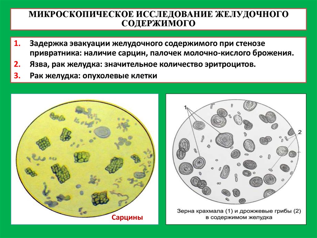 Исследование микроскопической картины кала