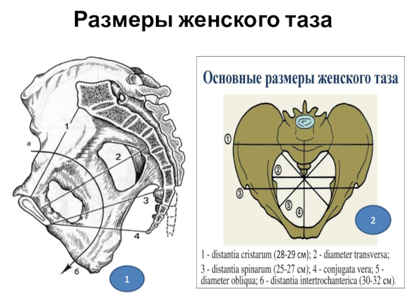 Размеры таза. Размеры женского таза. Линии размеров женского таза. Размеры малого таза женщины. Поперечный размер таза женщины.