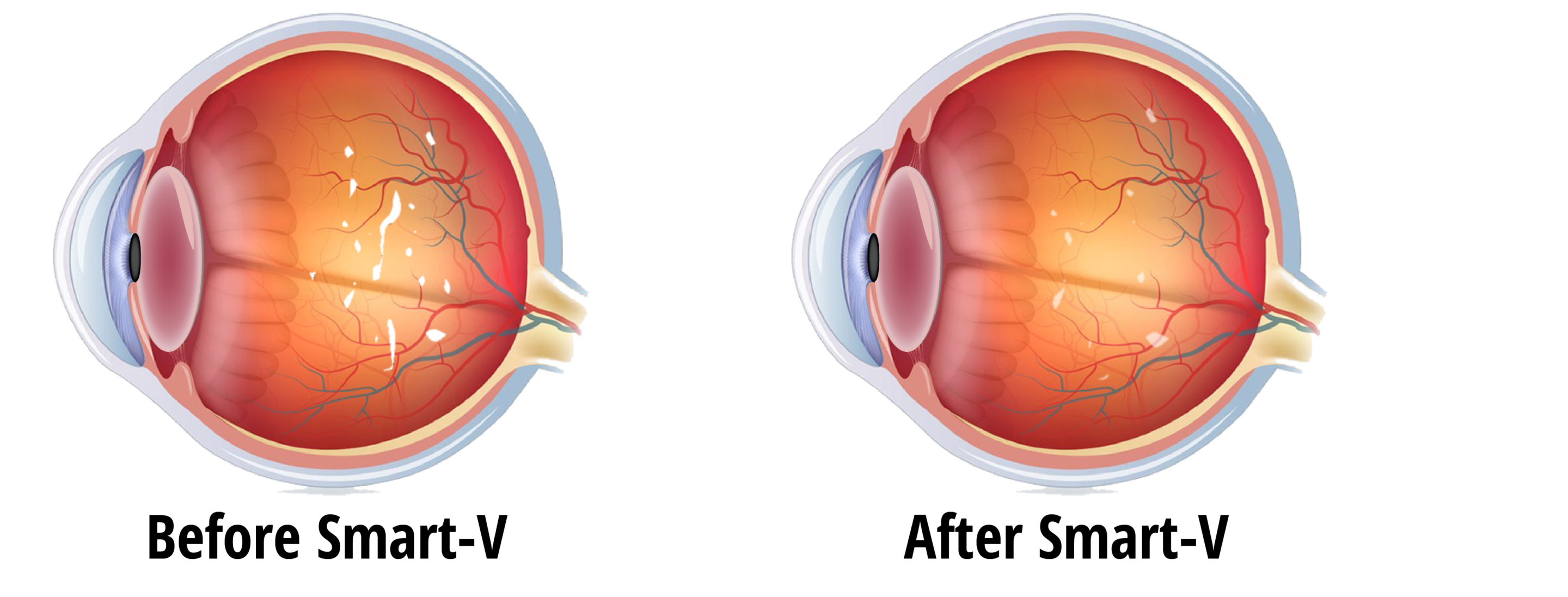 Ретинопатия катаракта глаукома. Патологии зрительного нерва глаукома. Здоровые глаза.